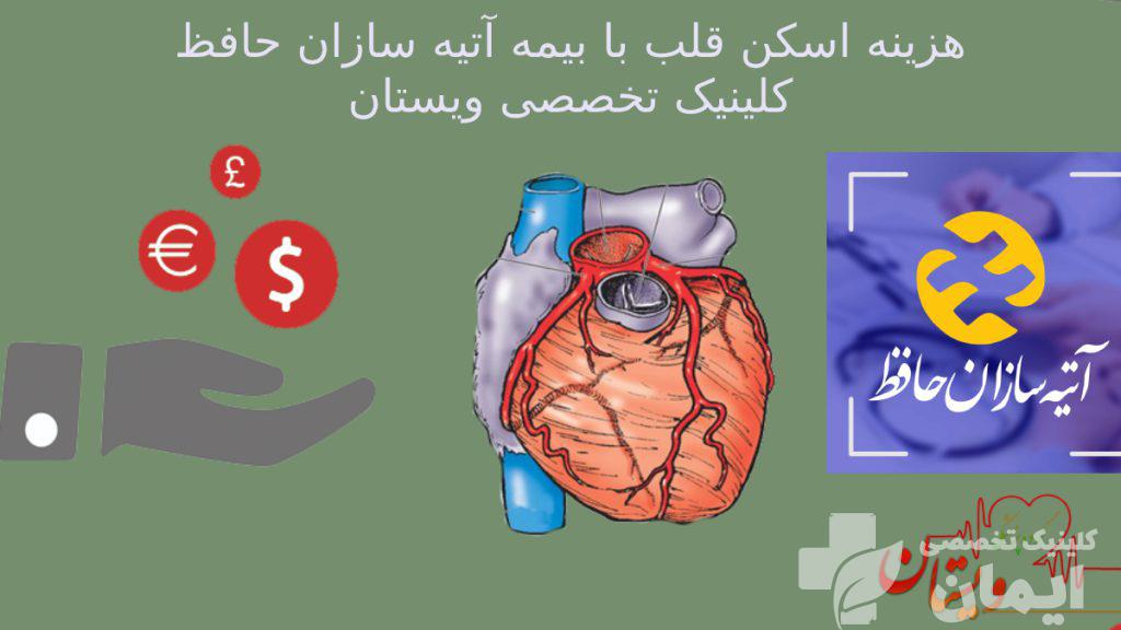 هزینه اسکن قلب با بیمه اتیه سازان حافظ کلینیک ویستان