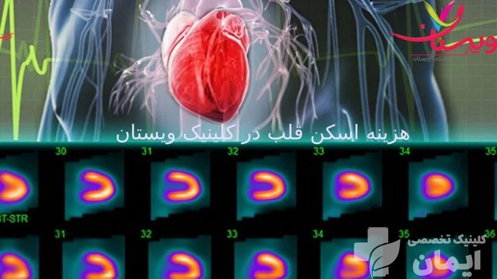 عکس هزینه اسکن قلب شکل اسکن قلب ویستان