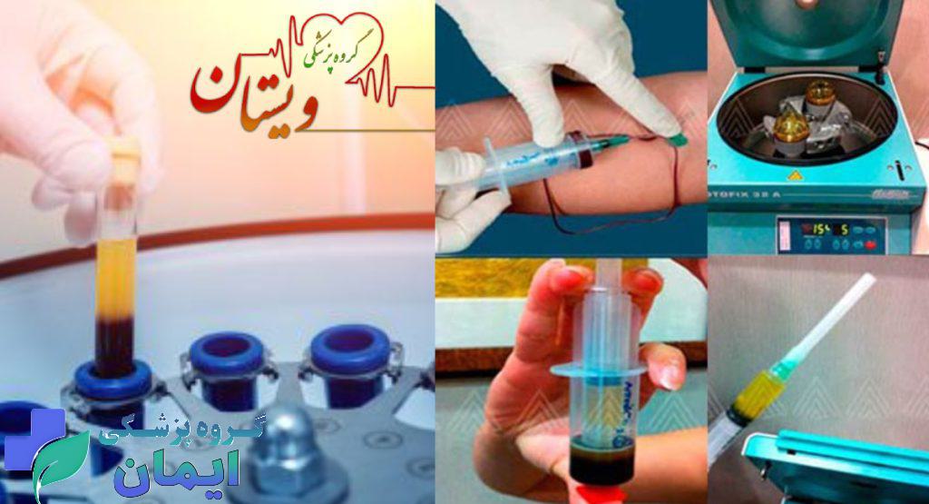 مراحل تهیه پی ار پی ویستان