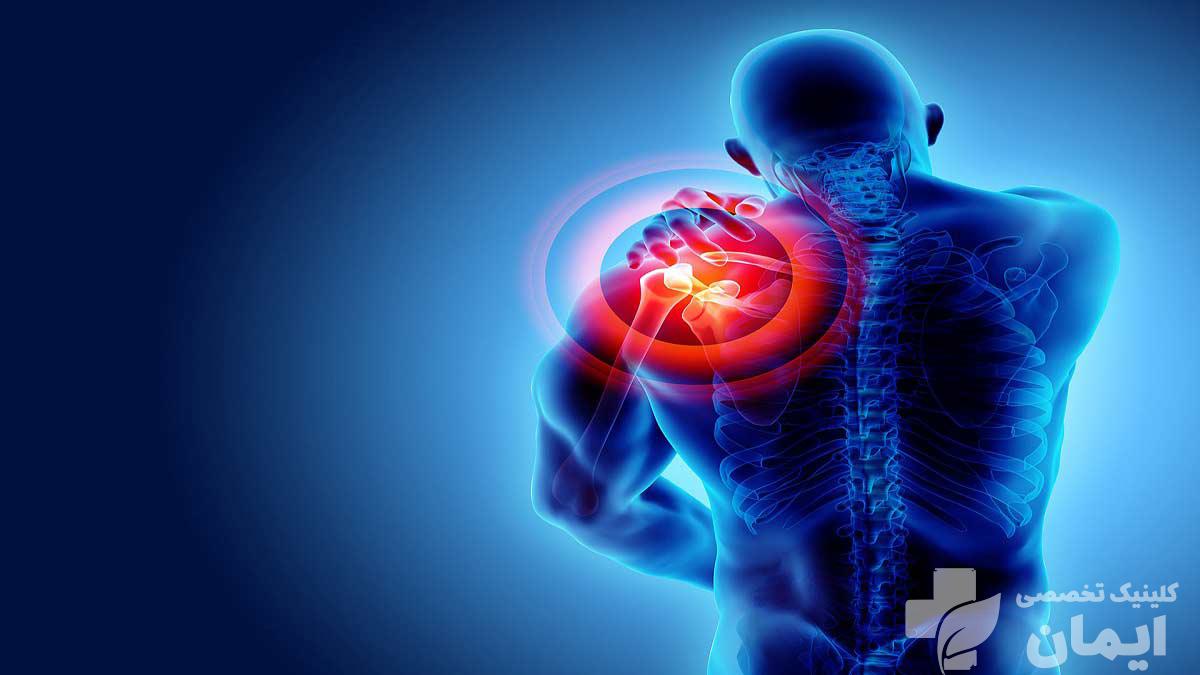 انواع شانه یخزده؟