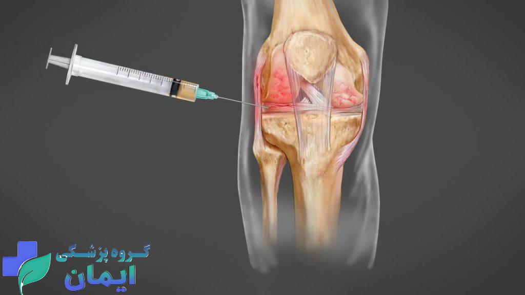 سلولهای بنیادی برای زانو