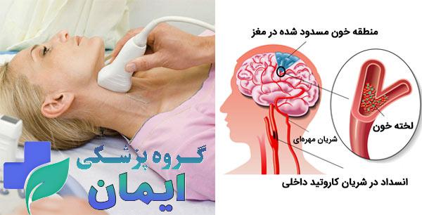 شناسایی نقطه ای که خون جمع شده شناسایی نقطه ای که خون جمع شده