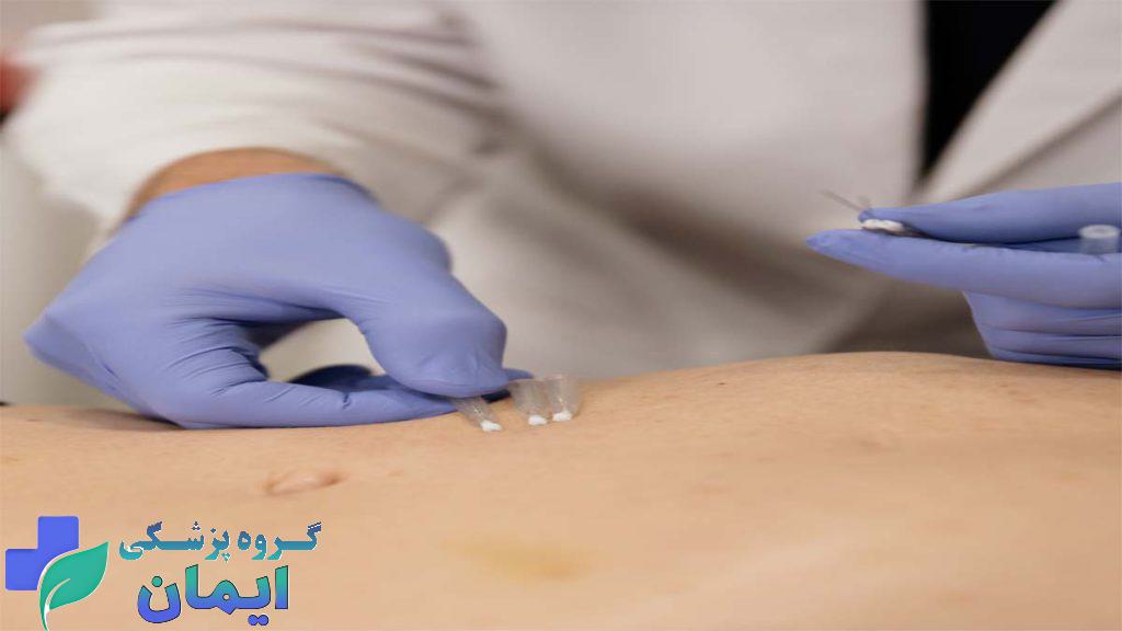 امبدینگ لاغری در کلینیک ویستان