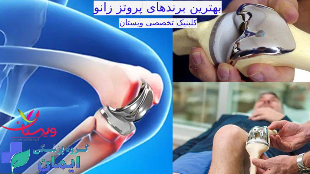 بهترین برندهای پروتز زانو برای عمل تعویض مفصل زانو