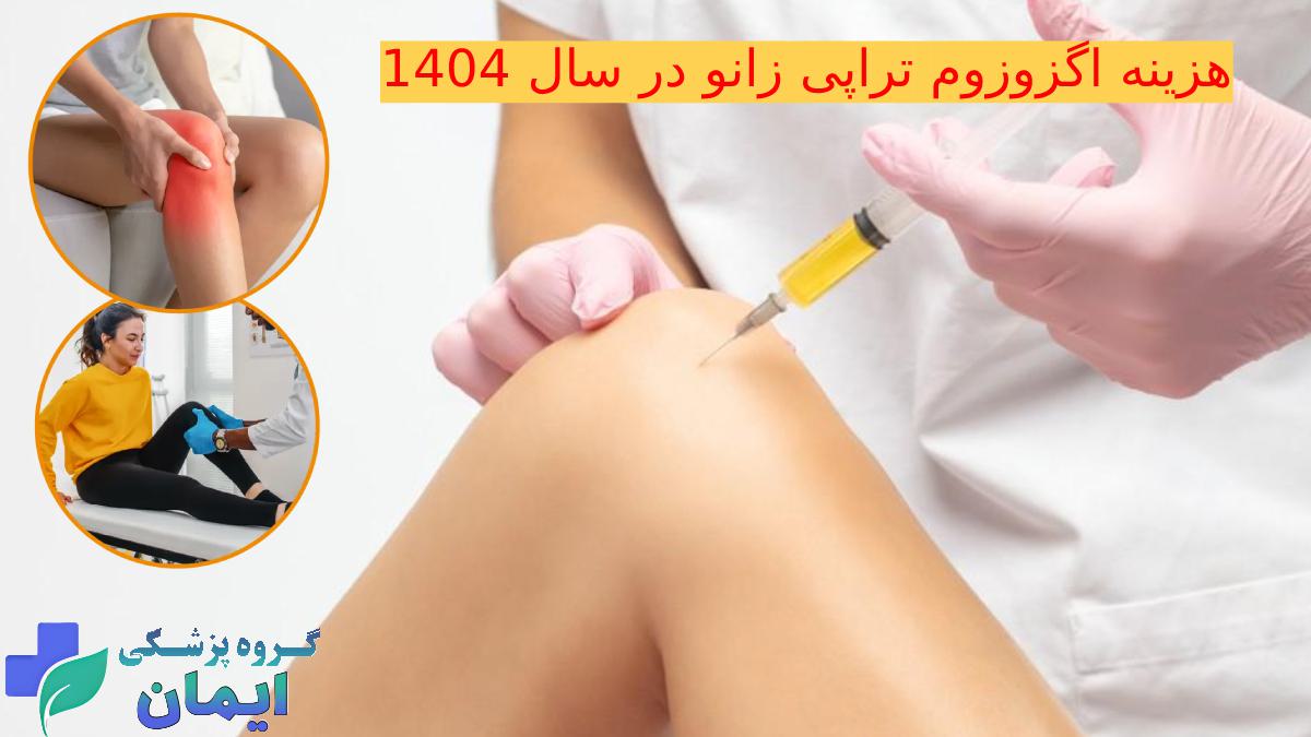 هزینه اگزوزوم تراپی زانو سال 1404
