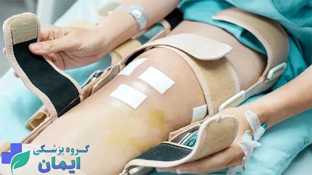 بیماری که تعویض مفصل زانو انجام داده