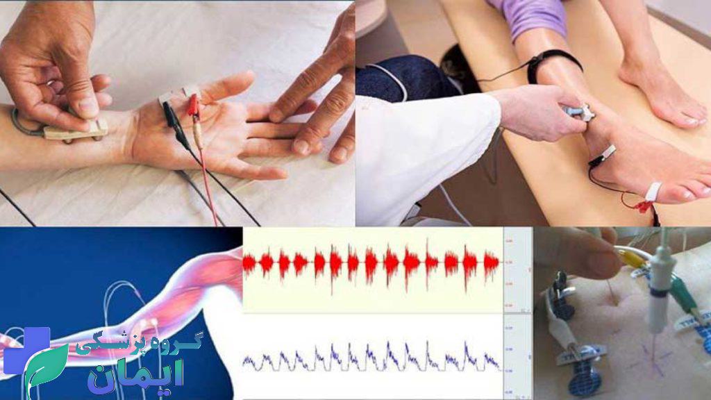hand and foot emg تست نوار عصب عضله چطوری انجام میشه؟ مراحل نصب الکترودها در دست و پا