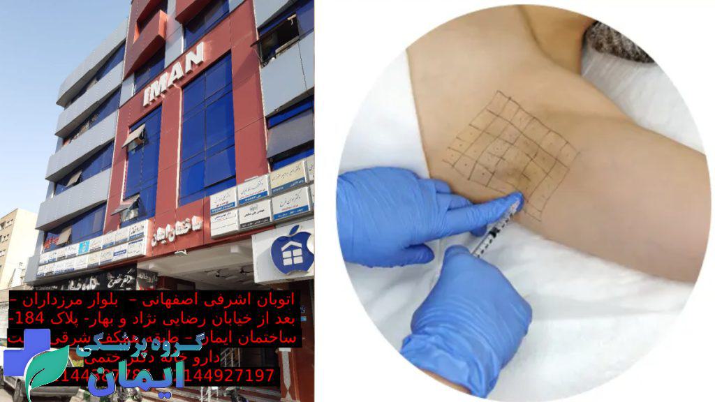 نقاط مربوط به تزریق بوتاکس زیربغل که با رسم شکل توضیح داده شده است. underarm-botox-injection