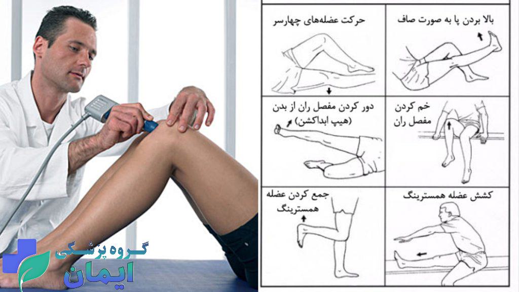 روش های غیرجراحی درمان پارگی مینیسک زانو تمرینات ورزشی برای درمان پارگی مینیسک زانو روش های غیرجراحی درمانی