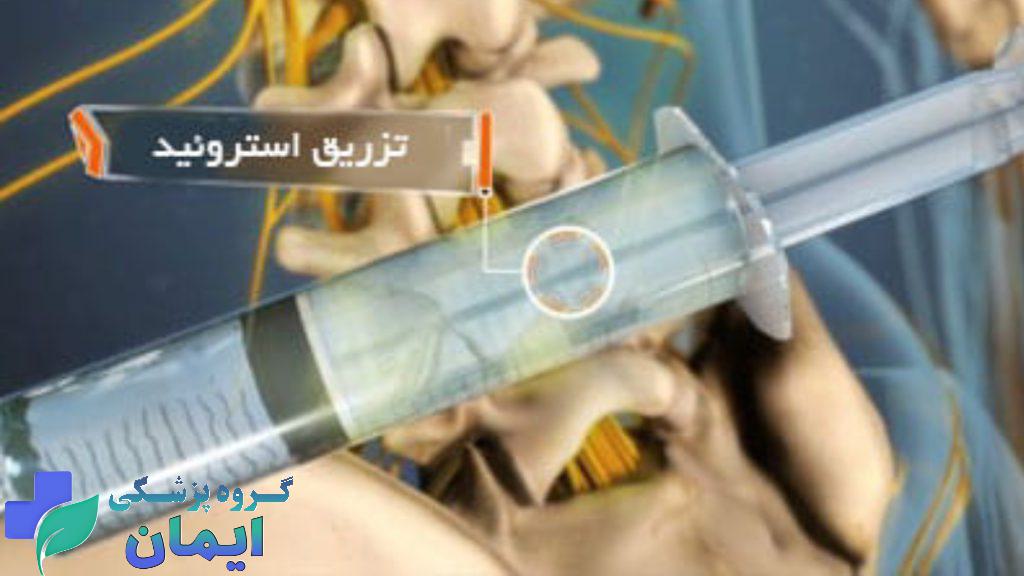 اپیدورال کمر