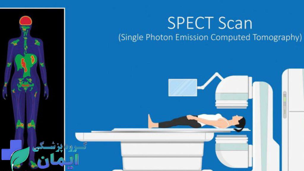 what is spect scan? اسکن اسپکت چیست؟