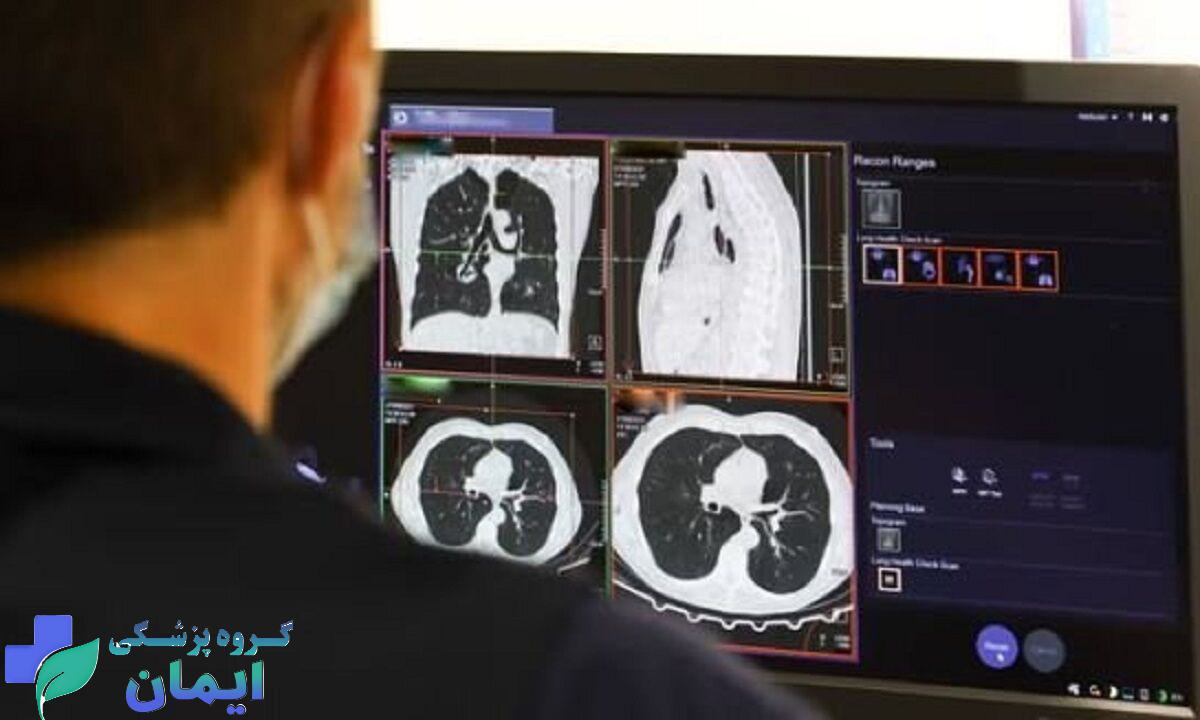 پزشک متخصص اسکن ریه می باشد