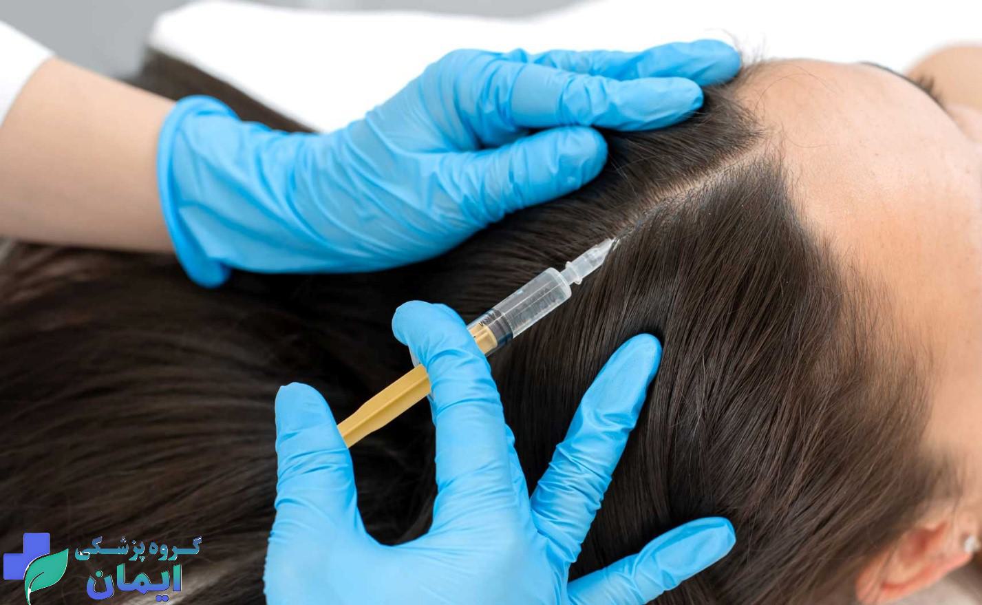 بیمار خانمی که ریزش مو دارد و پی آر پی انجام می دهد