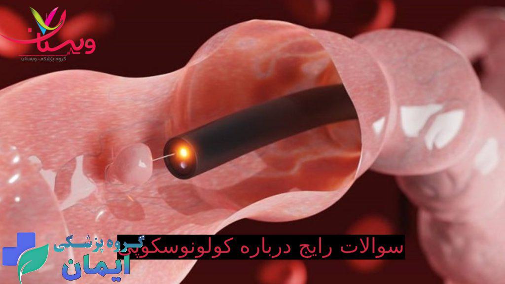 کولونوسکوپ داخل روده سوالات رایج در مورد کولونوسکوپی - تصویری از کولونوسکوپ در حال تصویر برداری از کولون روده