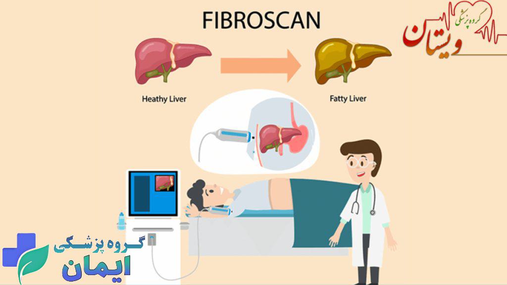 تشخیص کبد چرب با فیبرواسکن کبد تصویر انیمیشنی از تفاوت کبد نرمال و کبد چرب و تست فیبرواسکن کبد