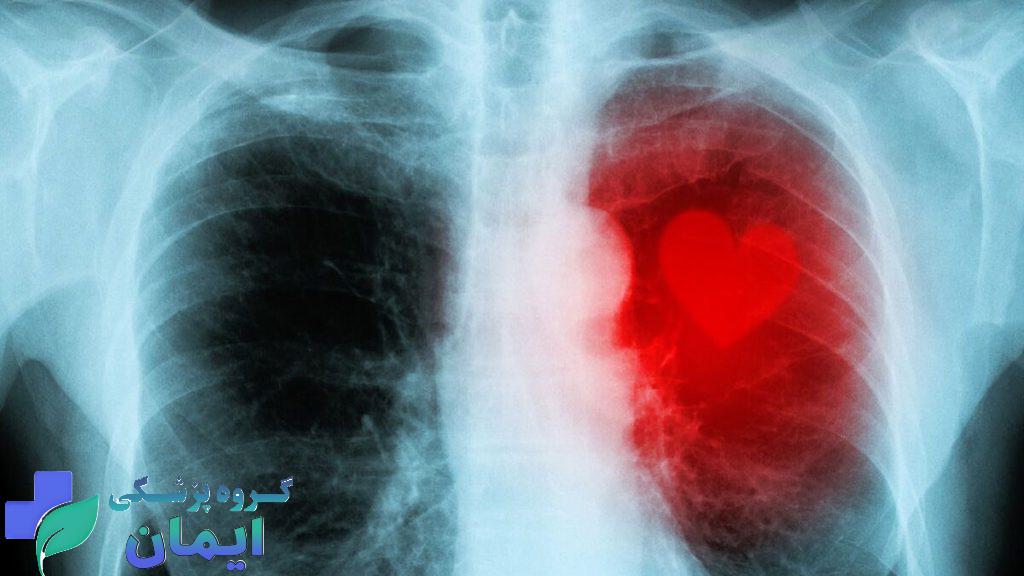 بیماری که دچار میوکاردیت شده است بیماری که دچار میوکاردیت شده است