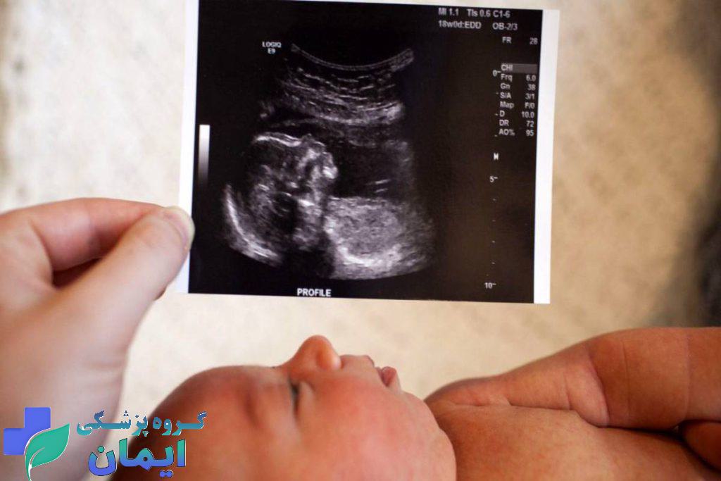 سونوگرافی ان تی در مراکز دولتی سونوگرافی ان تی در مراکز دولتی