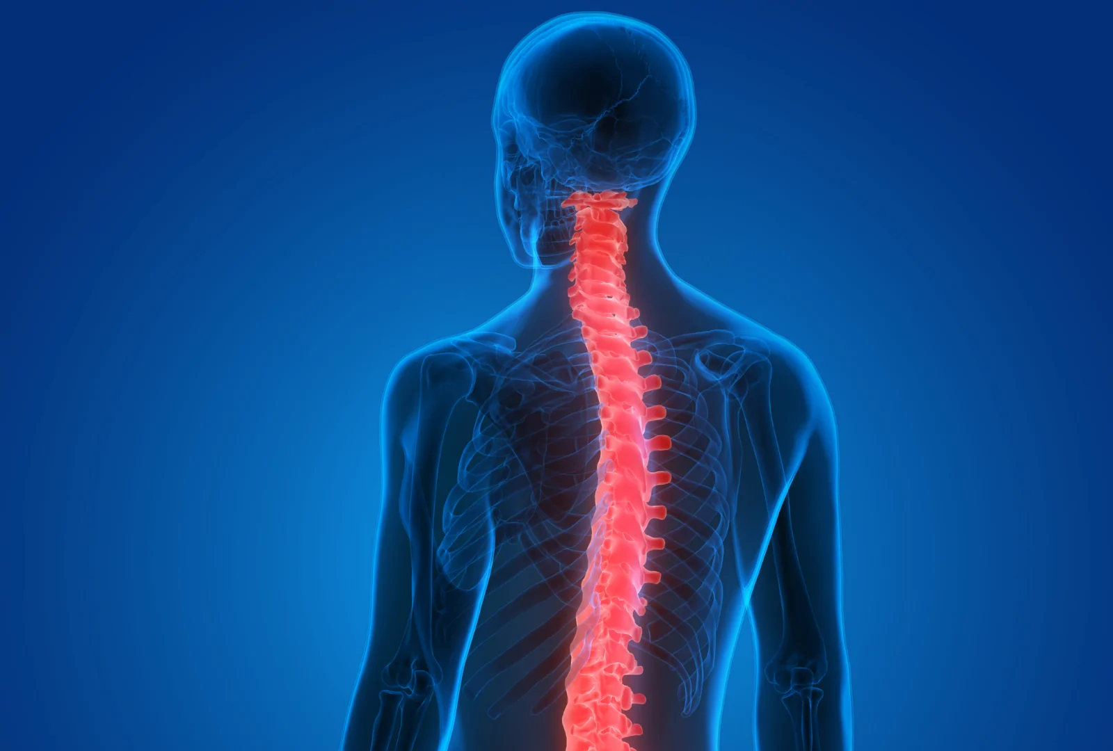 اقای که علائم تنگی نخاعی دارد