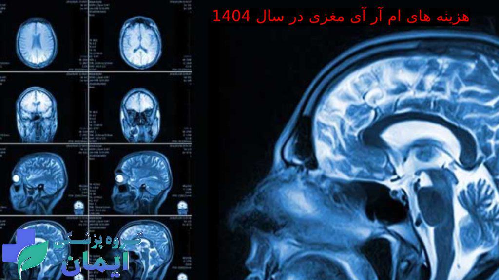 ام آر آی مغز تصاویر مربوط به ام آر آی مغزی