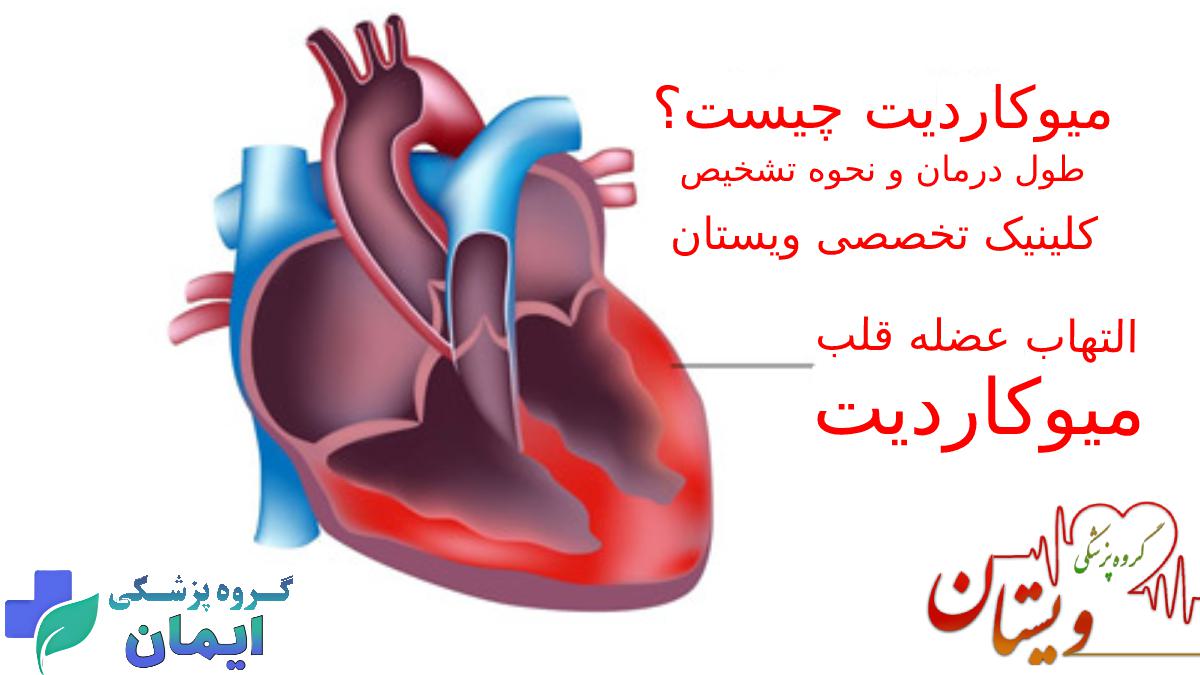 طول درمان میوکاردیت چقدر است؟