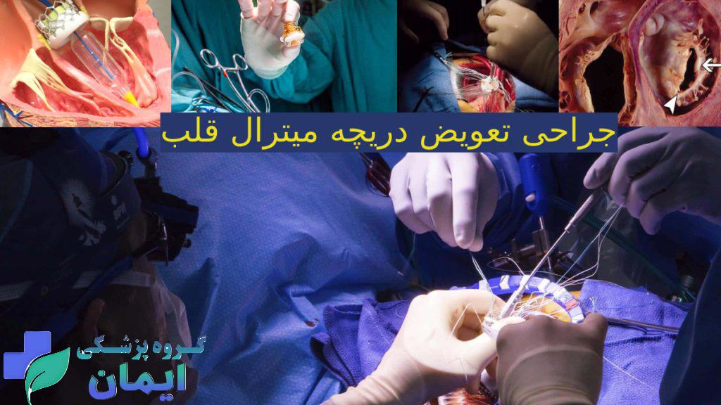 تصاویری مربوط به نحوه جراحی دریچه میترال قلب