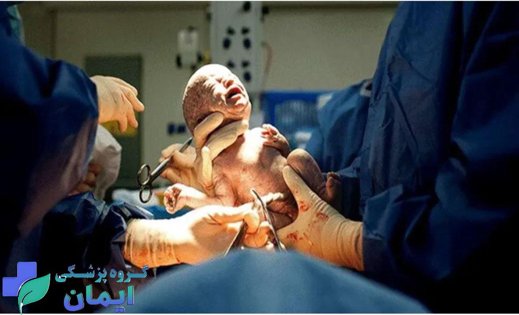 هزینه سزارین در اکثر شهر ها متفاوت است هزینه سزارین در اکثر شهر ها متفاوت است
