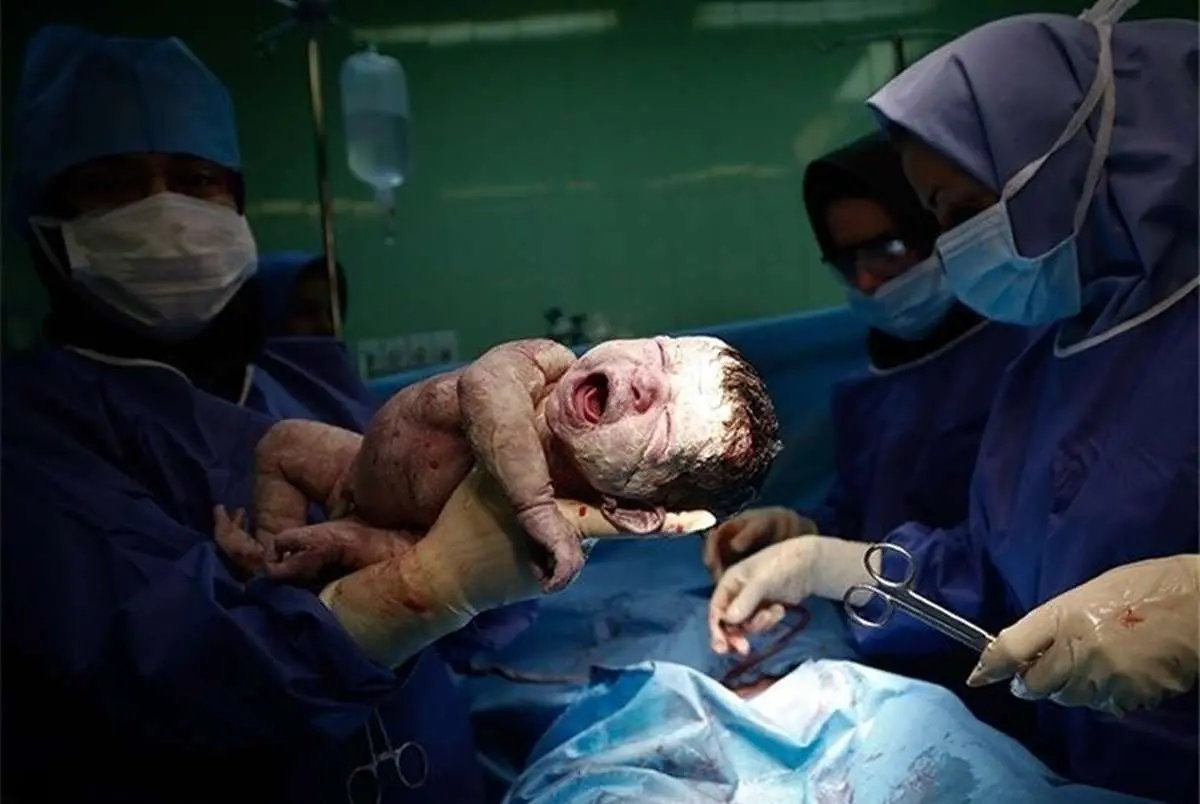 زایمان سزارین در بیمارستان خصوصی