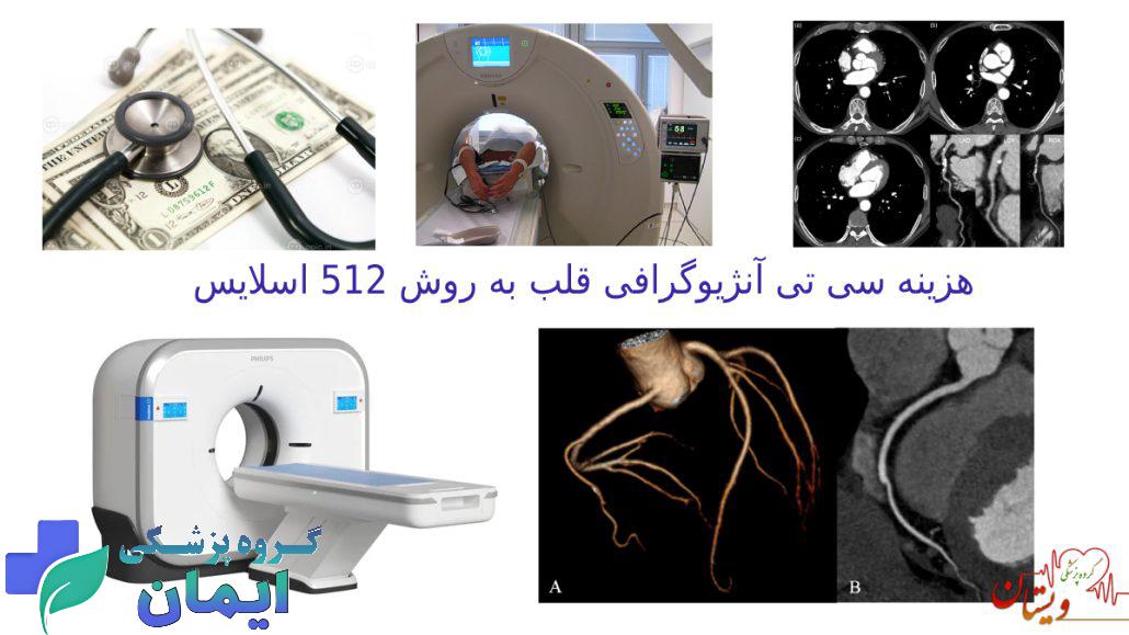 هزینه سی تی آنژیو 512 اسلایس قلب در سال 1404