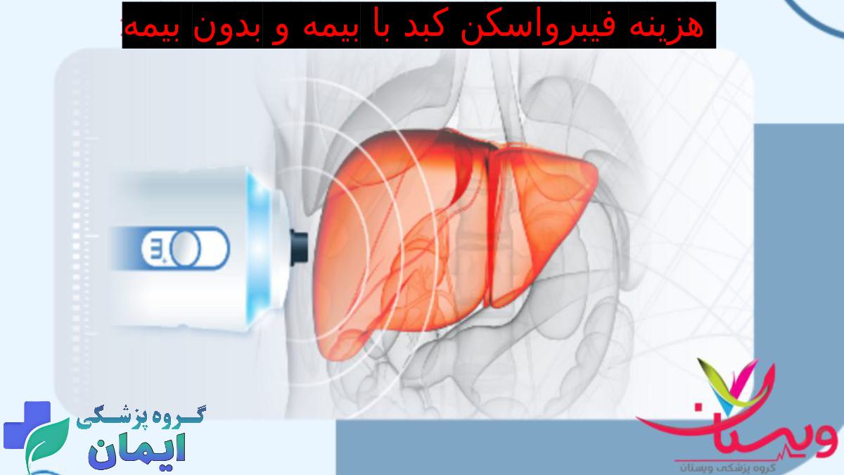 هزینه فیبرواسکن کبد با بیمه و بدون بیمه