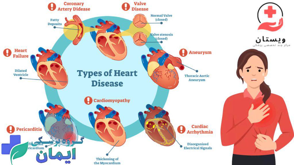 انواع بیماری قلبی تصیری شماتیک از انواع بیماری قلبی با یک زن که درد قلب دارد