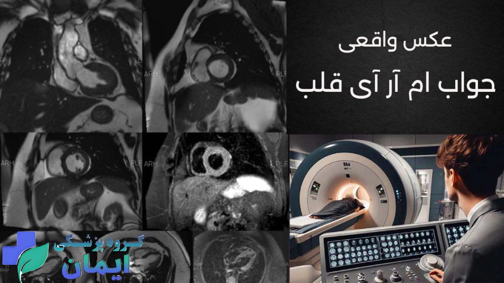 تصاویر واقعی از ام آر آی قلب - تصویر اپراتور پشت سیستم در حال بررسی نتایج ام آر ای 