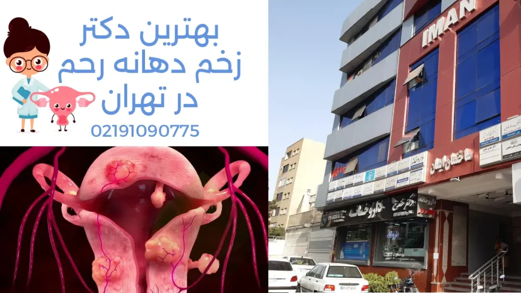 درمان زخم دهانه رحم ساختمان ایمان + بهترین دکتر برای درمان زخم دهانه رحم