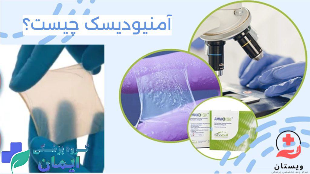 شکل و اندازه امنیودیسک تصویری واقعی ازآمنیودیسک و متخصص در حال بررسی آن زیر میکروسکوپ