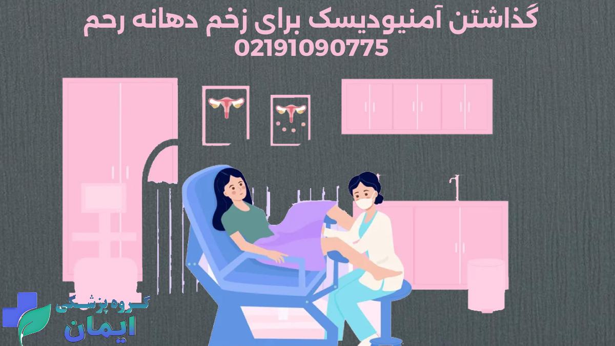 گذاشتن امنیودیسک برای زخم دهانه رحم