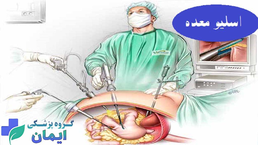 عکس از عمل اسلیو معده