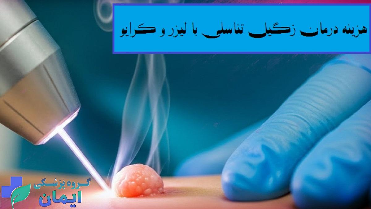 هزینه لیزر زگیل تناسلی