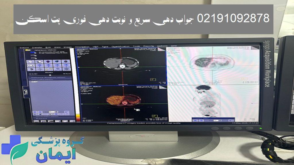 تصویری از جواب پت اسکن در کلینیک پت اسکن شهر ری تهران خیابان غیوری 02191092878