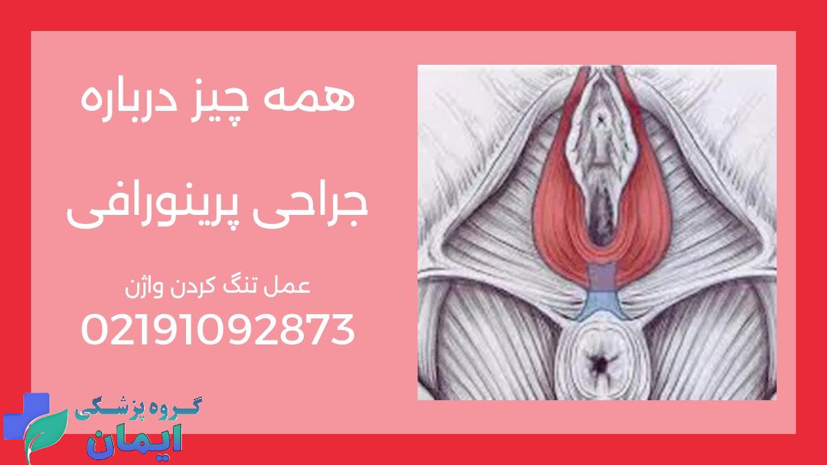 جراحی پرینورافی چیست؟ نکات مهم عمل تنگ کردن واژن